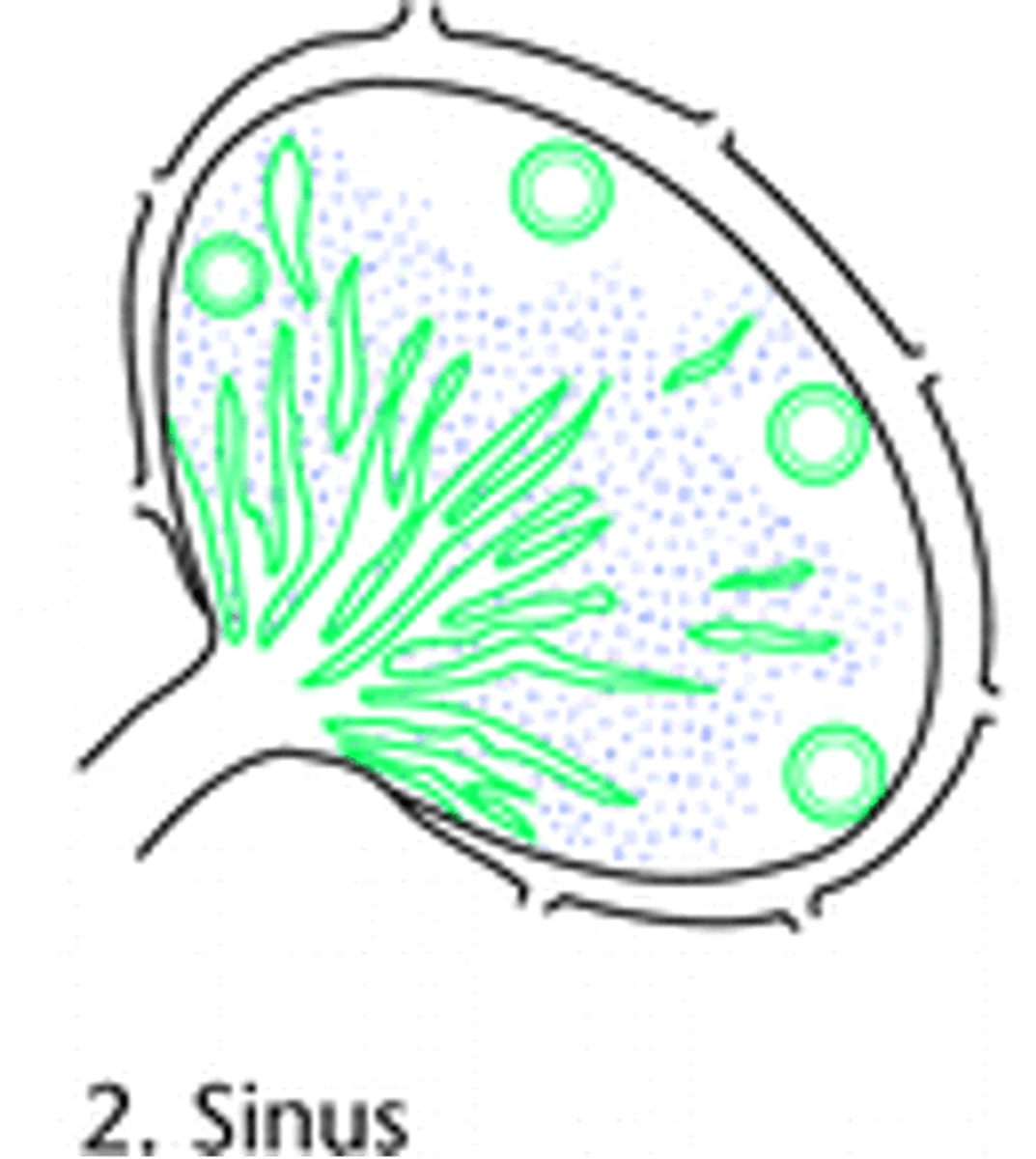 <p>What are the causes of Sinus Chronic Lymphadentis?</p>