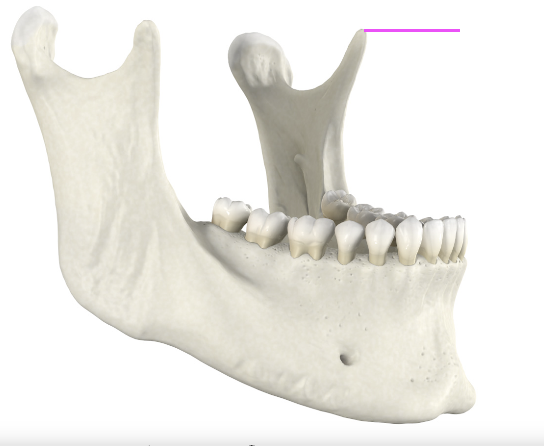 <p>What bone marking is this?</p>