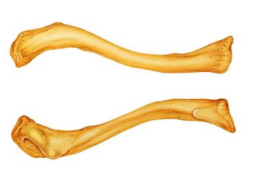 <p>Is the indicated bone from the right or left side of the body?</p>