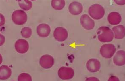 <p>platelet</p>