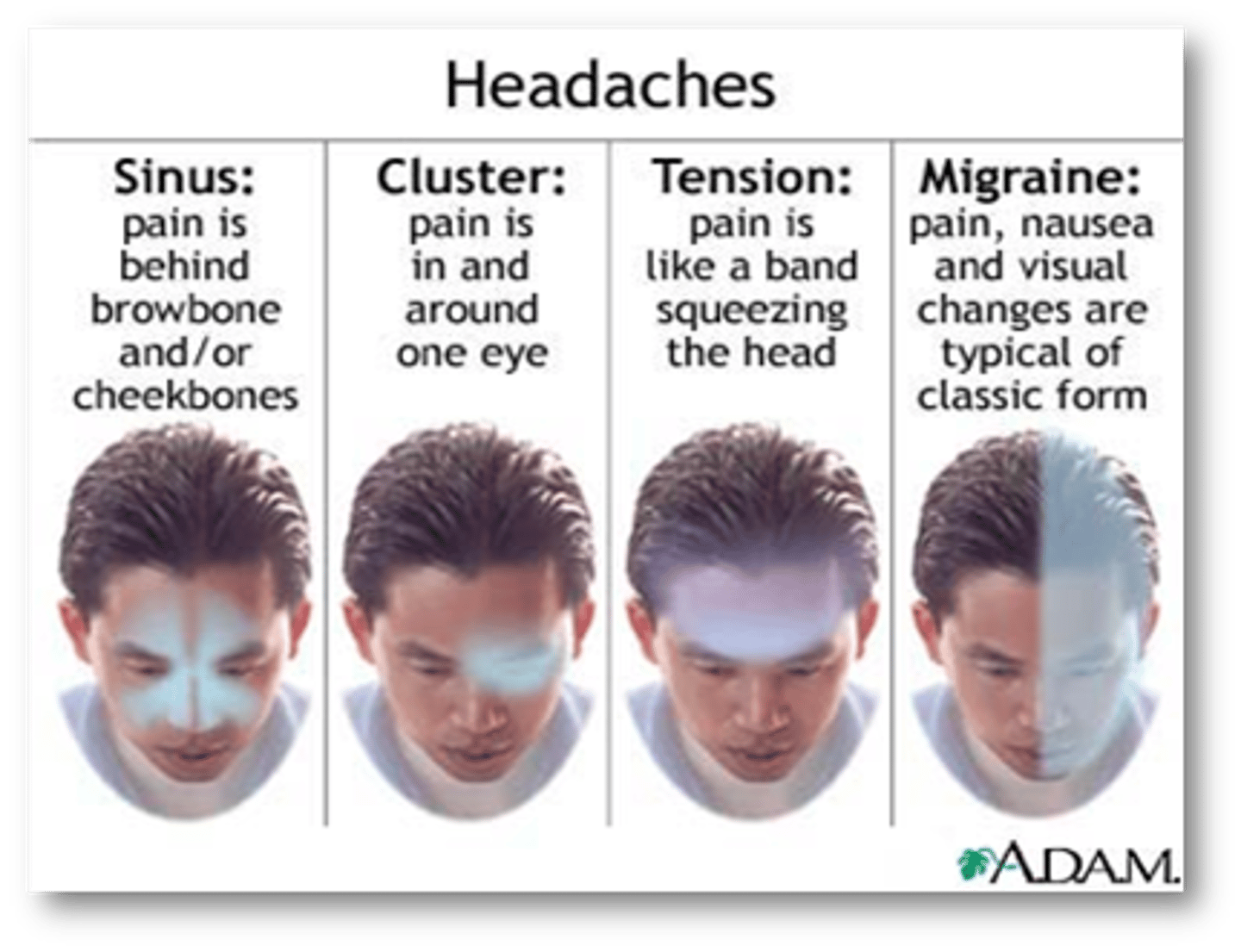 <p>sinus - behind forehead and/or cheekbones</p><p>cluster - in and around 1 eye</p><p>tension - hat band pain</p><p>migraine - pain, nausea, visual changes</p>