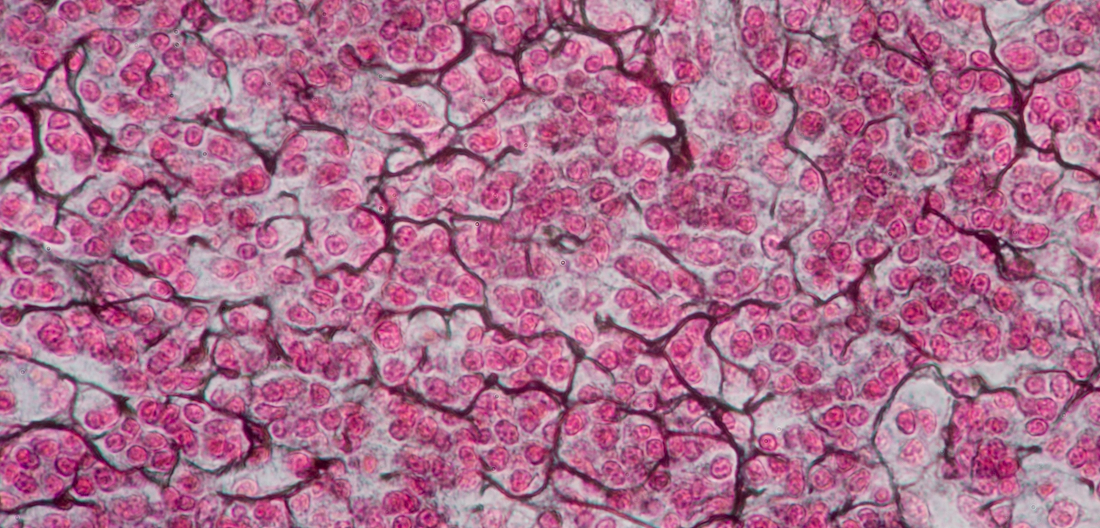 <p>Location and function of reticular connective tissue (loose)</p>