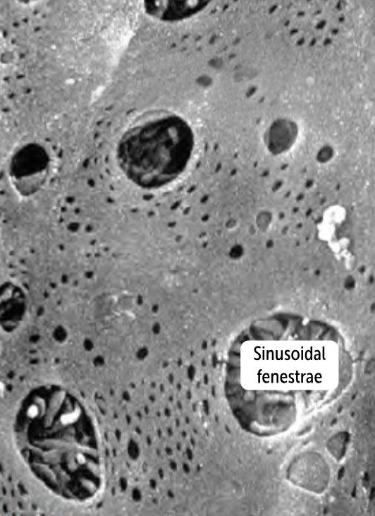 <p>Sinusoidal (Discontinuous) Capillaries</p><ul><li><p>the most permeable capillaries </p></li><li><p>has big gaps between the endothelial cells and within the basement membrane, called clefts</p></li><li><p>found in the liver and spleen, organs whose primary roles are filtering out larger molecules </p></li></ul><p></p>
