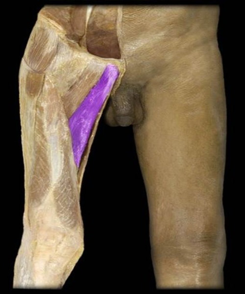 <p>What is the name of this muscle, highlighted in purple?</p>