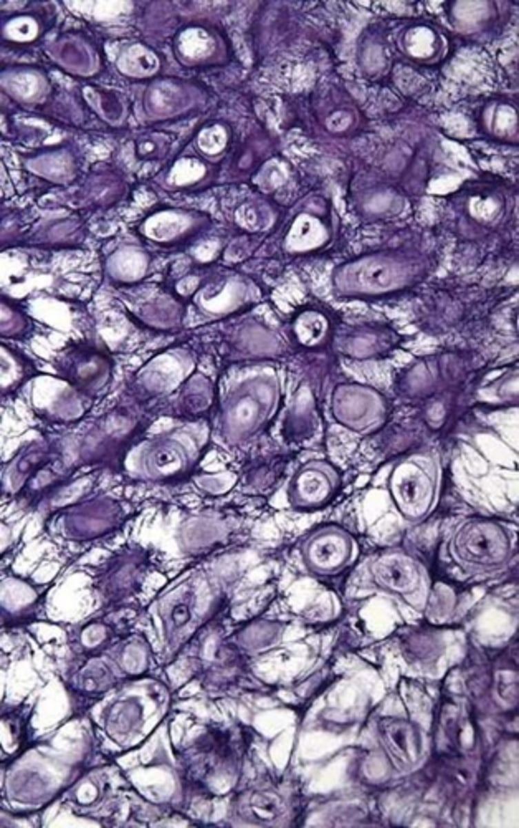 <p>-flexible</p><p>-ear, epiglottis</p>