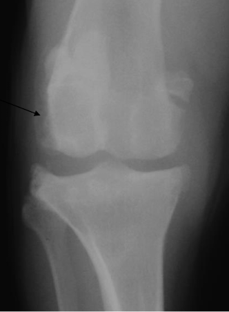 <p>What is the arrow pointing to?</p>