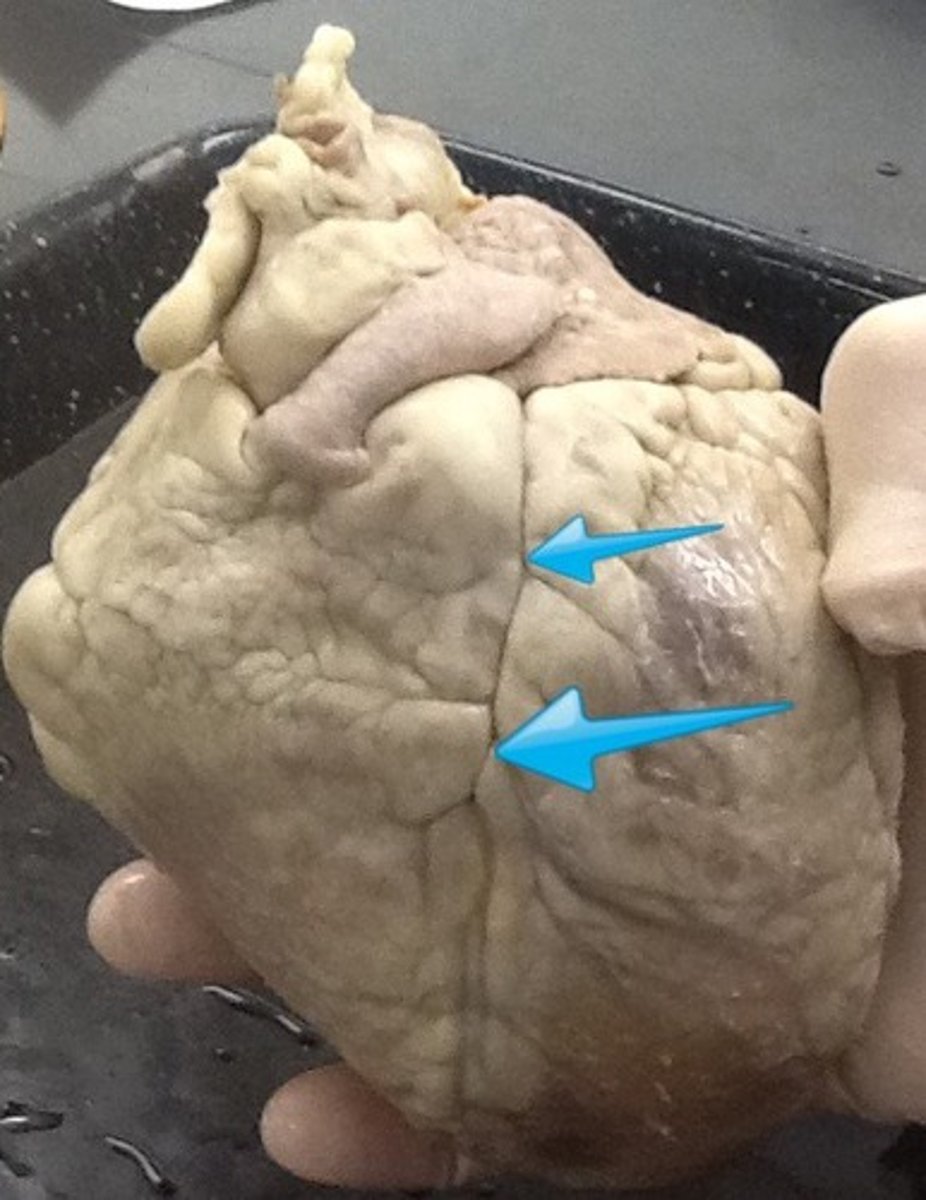 <p>Identify the structure.</p>