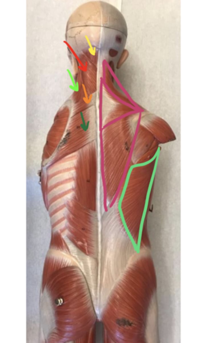 <p>ID the structure of the dark green arrow.</p>