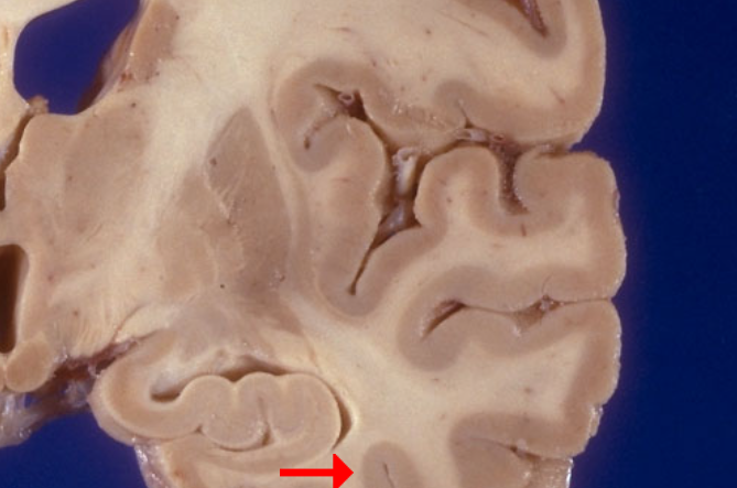 <p>Label this brain region of the temporal lobe</p>