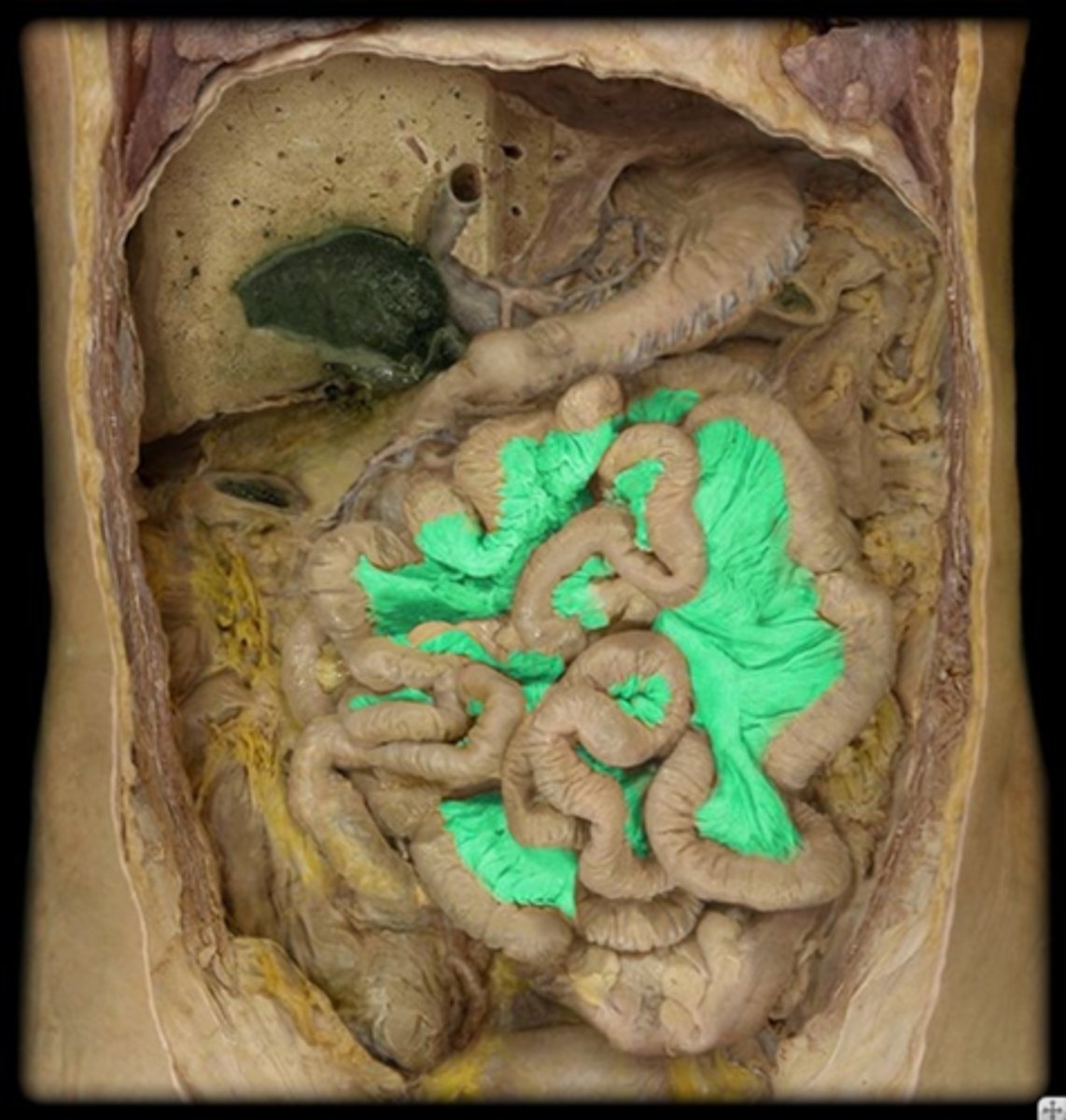 <p>Identify this structure.</p>