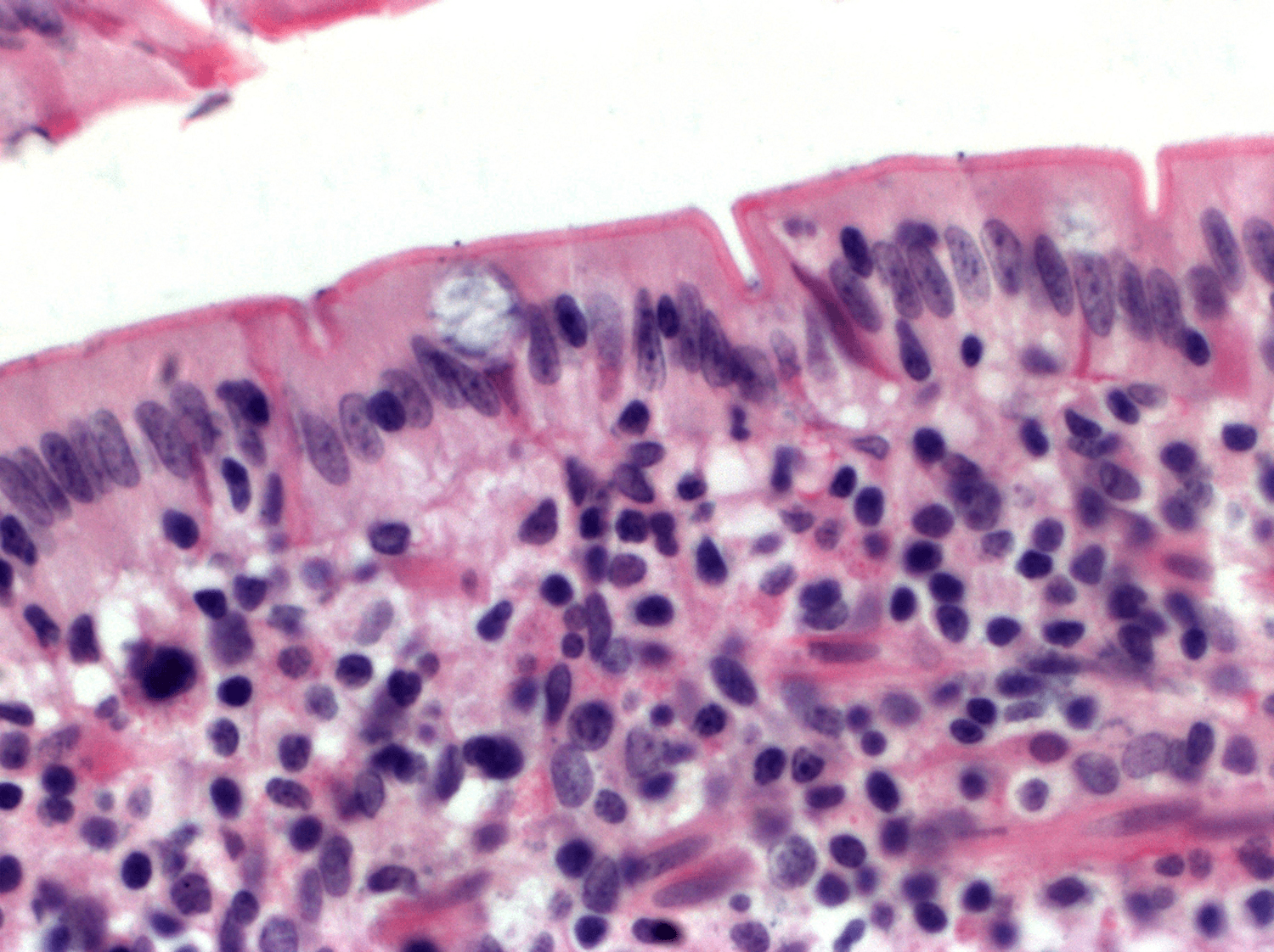 term image