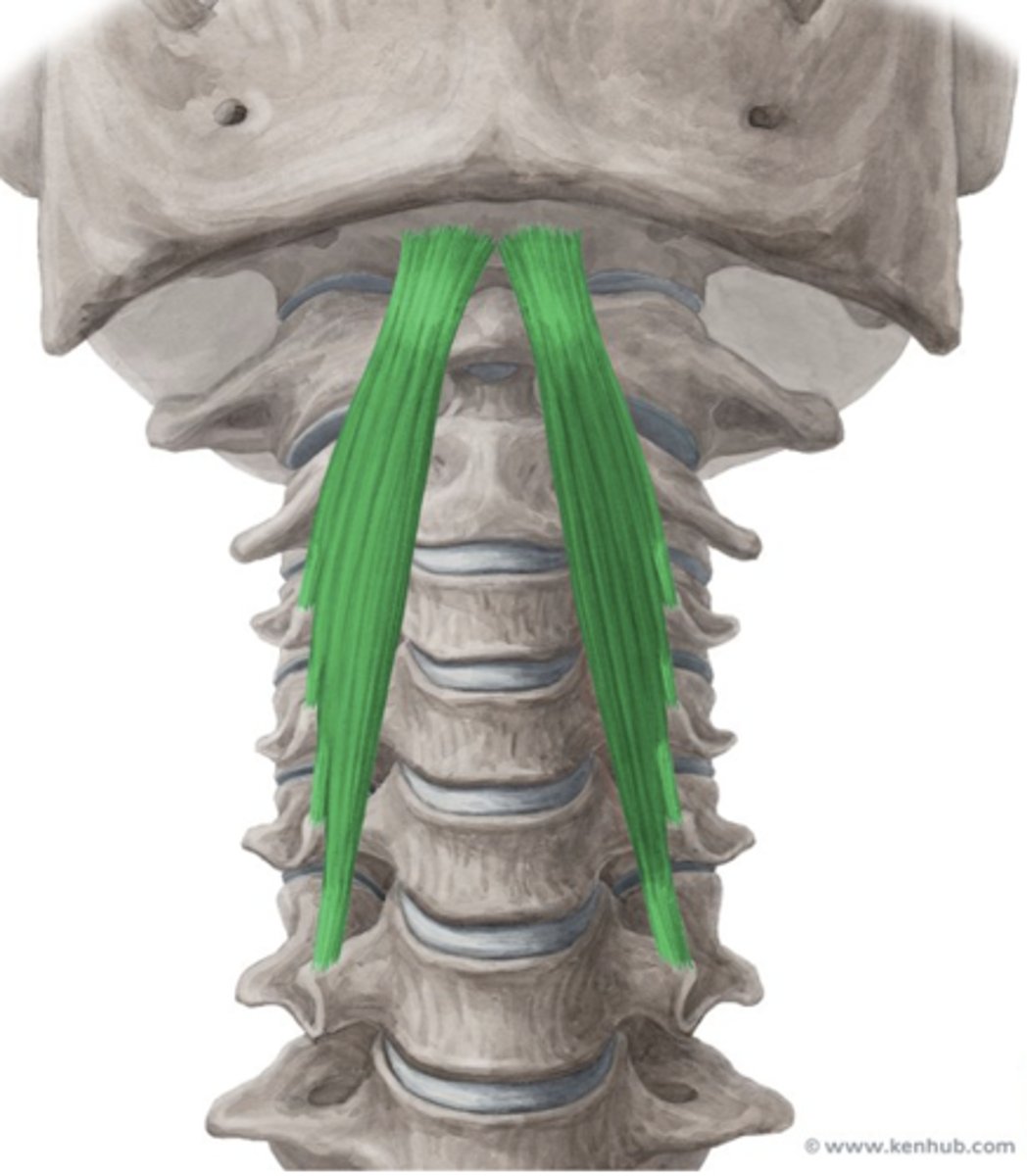 <p>occipital bone</p>