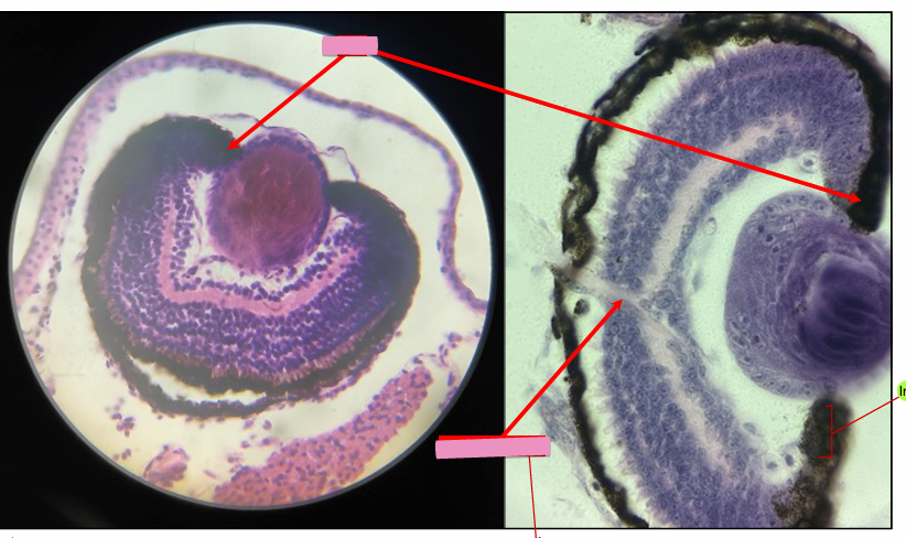 <p>what level<br>primary brain vesicle<br>parts</p>