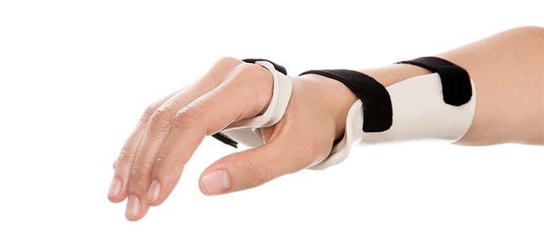 <ul><li><p>supports wrist in 10-20 ext to prevent contractures</p></li><li><p>allows digits to function</p></li><li><p>volar or dorsal</p></li></ul><p></p>