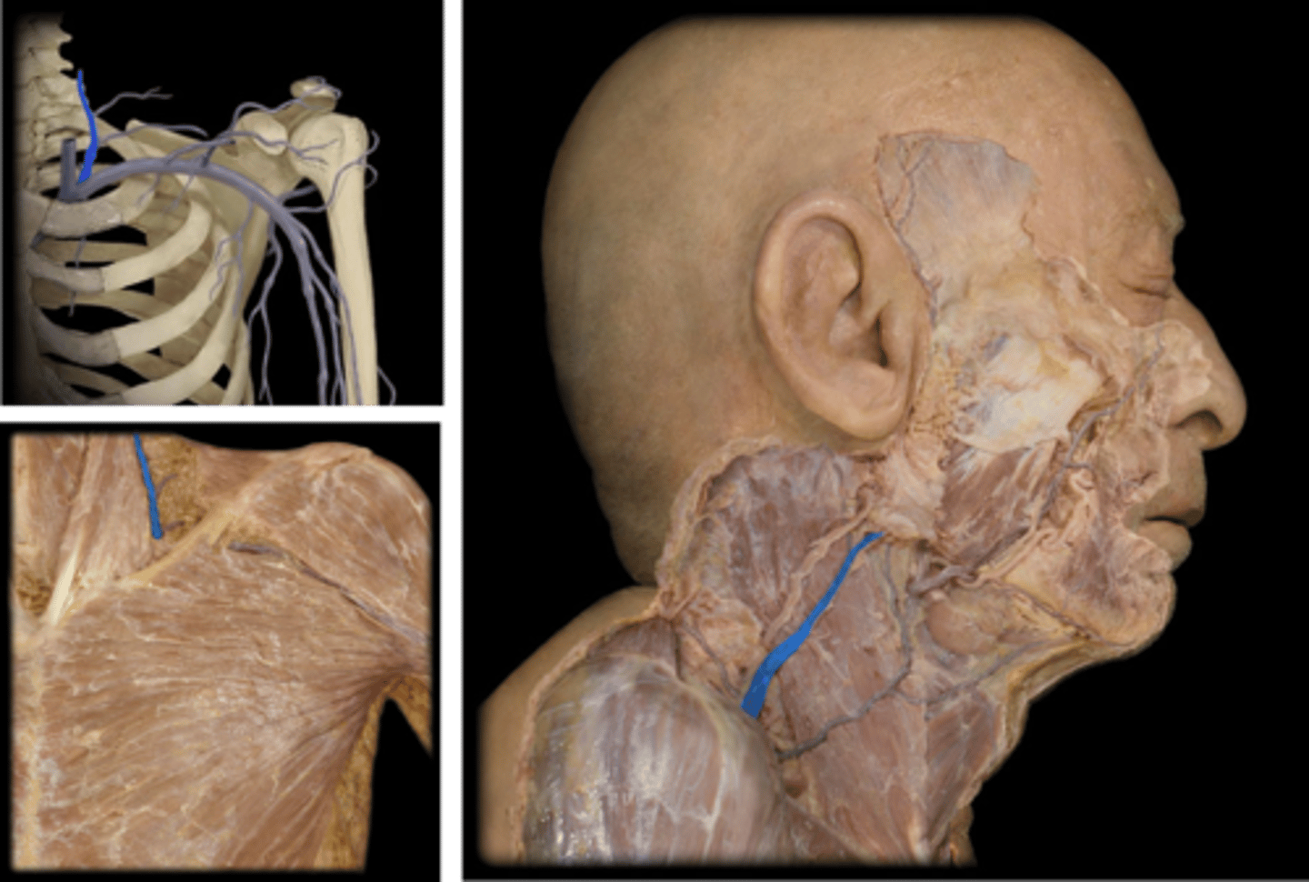 <p>Name these vessels.</p>