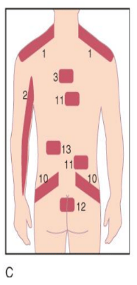 <p>Across left and/or right side of lower back into hip(s) (10 in image).</p>