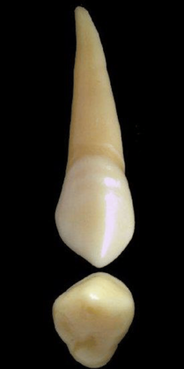 <p>what tooth is this &amp; why?</p>
