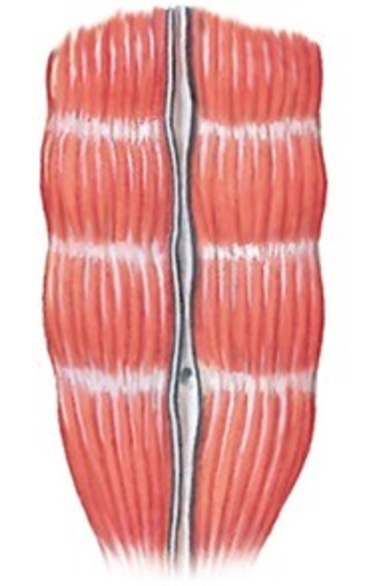<p>- muscle fascicles run parallel to axis of muscle</p><p>- tendon on either side</p><p>- look long and ropelike</p><p>- fewer fibers than other types</p><p>- longer fibers so able to shorten more</p>