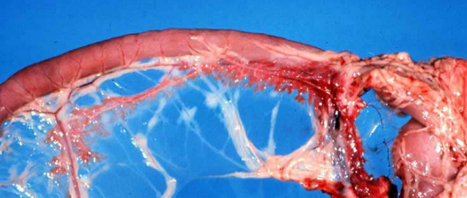 <p>2 possible morphologic diagnosis</p>