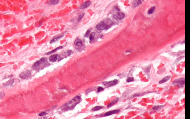 <p>Osteoclasts</p>