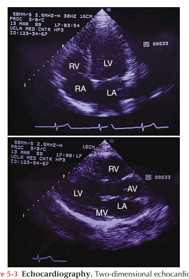 <p>It uses ultrasound technology to measure shifts in frequency caused by object movement. For example, it is used to evaluate blood flow velocity and turbulence in the heart and peripheral circulation.</p>