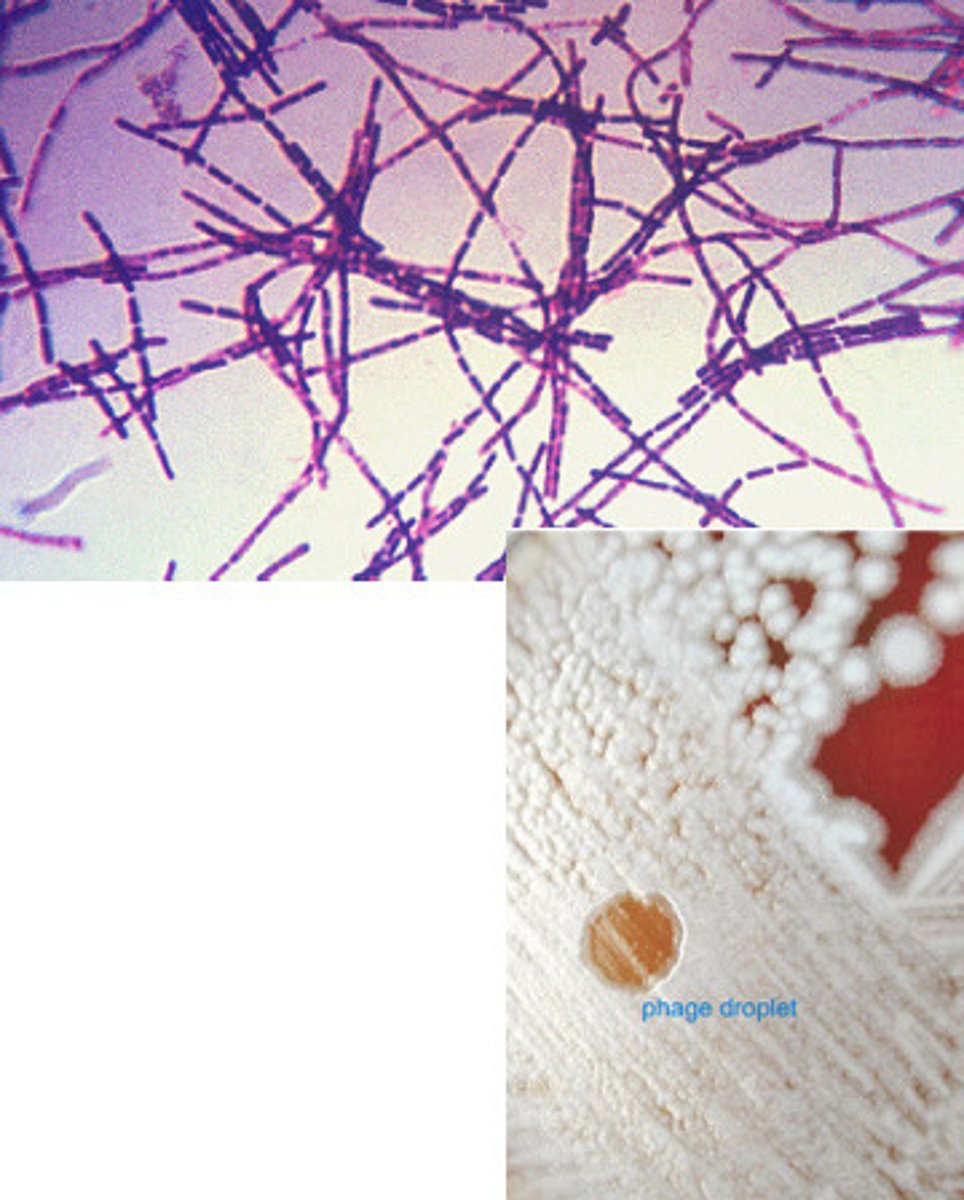 <p>GPB, large rods with spores, catalase pos, lysis with gamma phage, medium large feathered colonies, non motile, non haemolytic anaerobic</p>