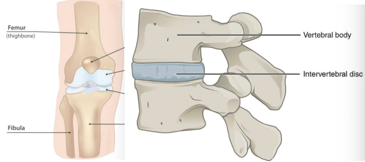 <p>CT that absorbs shock and resists tension, compression, and shearing forces</p>