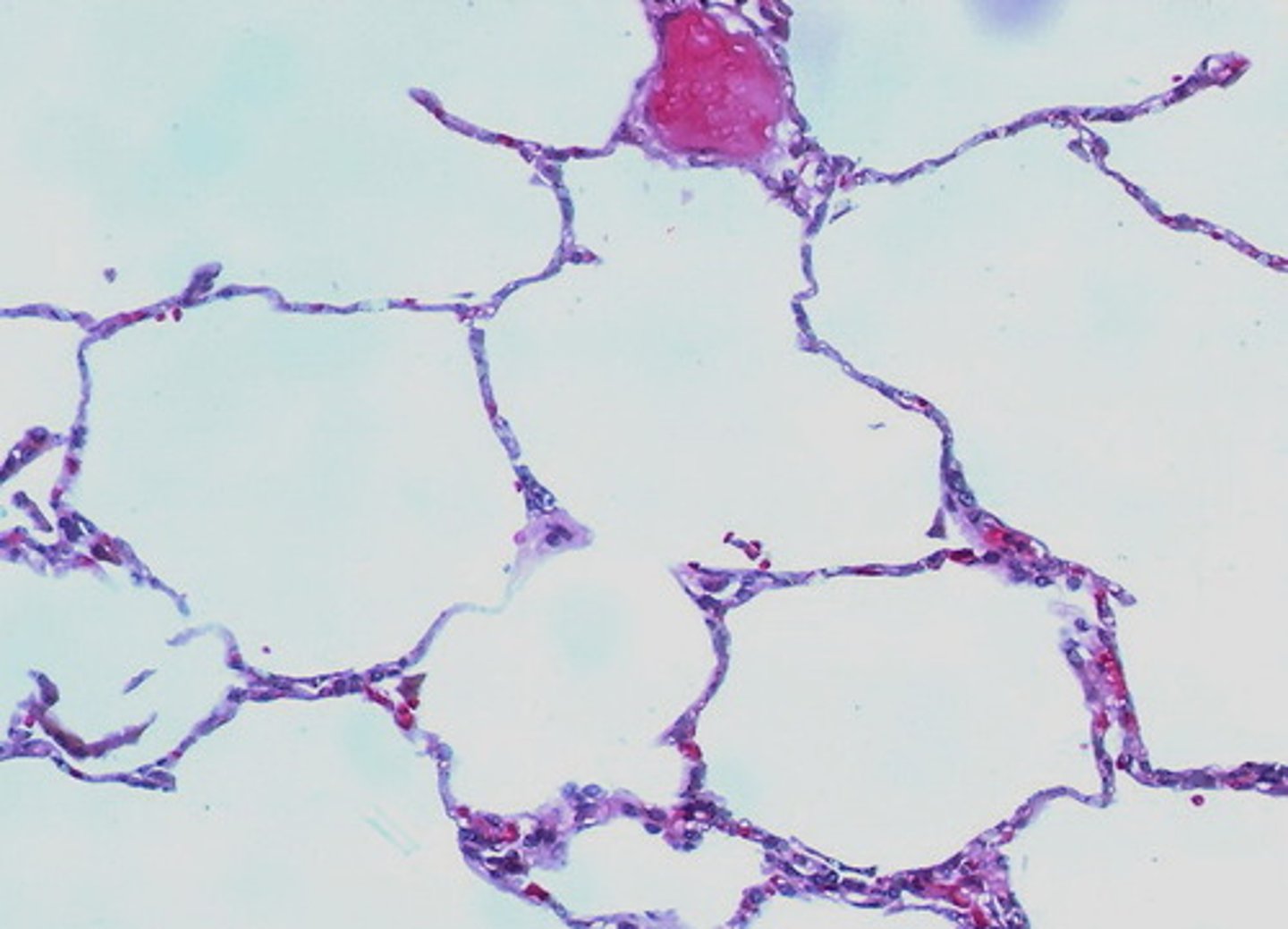 <p>Terminal air sacs that constitute the gas exchange surface of the lungs.</p>
