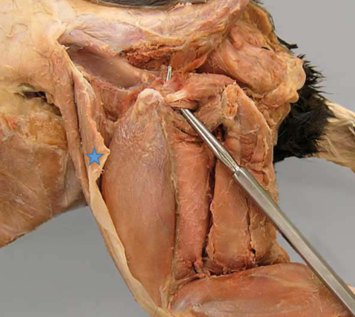 <p>Tensor fasciae latae m.</p>