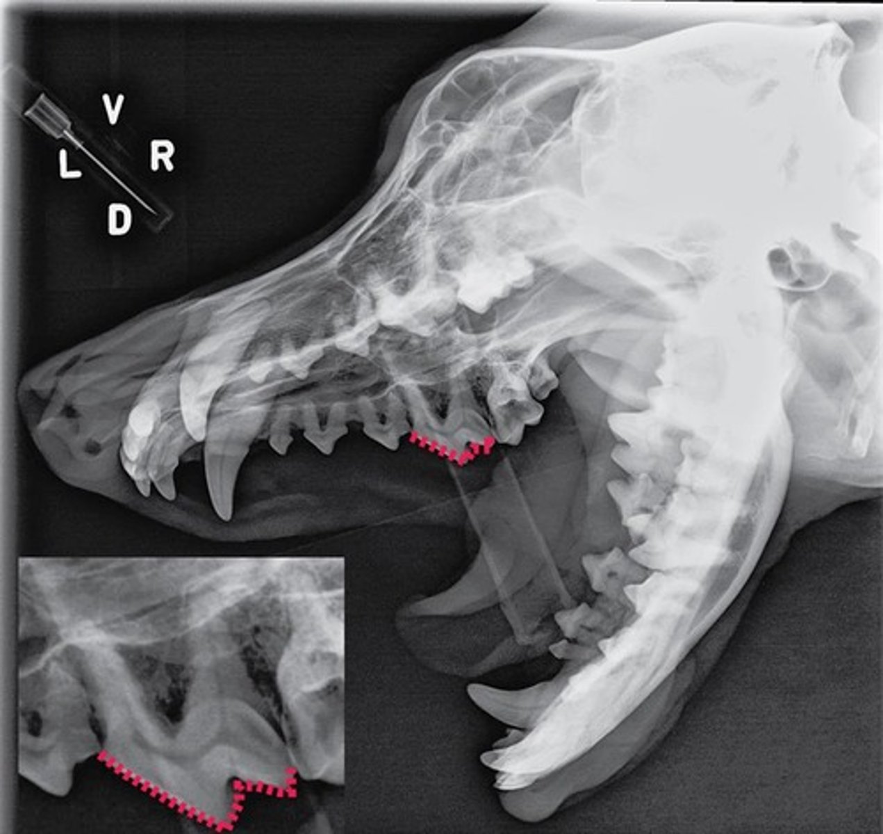<p>What compound covers the external part of the tooth outlined?</p>