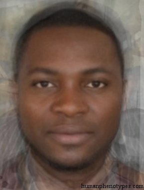 <p>Identify this Phenotype</p>