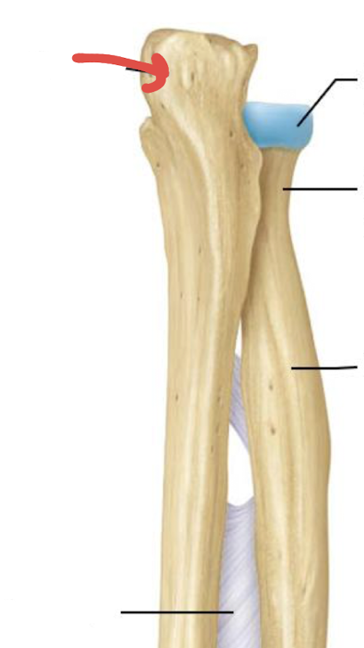 <p>what is this part of the ulna?</p>