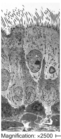 <p>What microscope produced this image and why?</p>