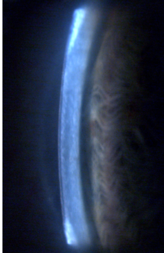 <p>what ration would this angle be? 1:</p>