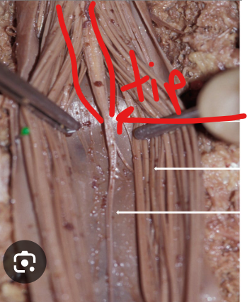 <p>the cone-shaped lower end of the spinal cord.<span>&nbsp;</span></p><p><span>l</span>ocated at the level of the first or second lumbar vertebra (L1-L2)</p><p></p>