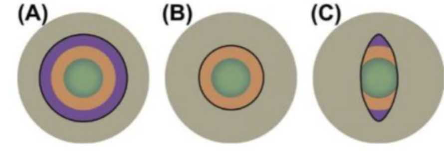 <p>Pupil shape (explain each)</p>