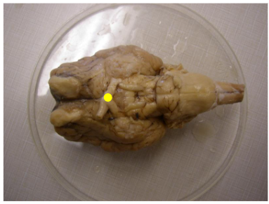 <p>Name the part of the brain marked by the yellow dot.</p>