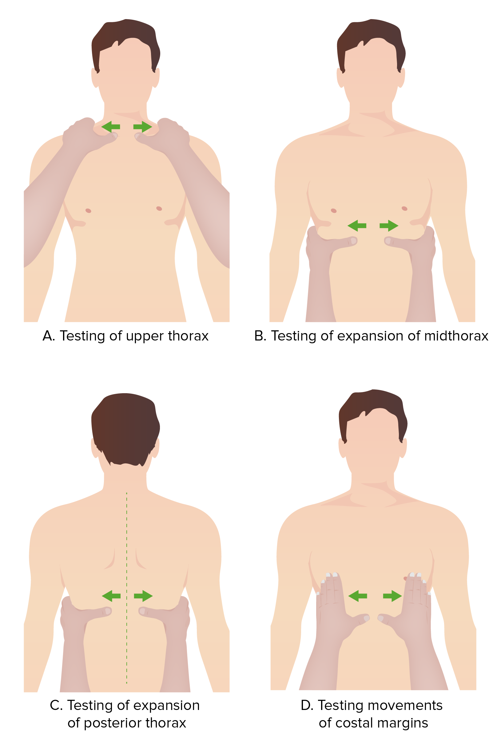<p>aka: lung excursion<br><strong>chest expansion</strong></p><ol><li><p>place thumb on each costal margin posteriorly<br>-at level of+parallel to 10th rib→form loose skin fold<br>-pt unable to sit→anterior chest→hands along each costal margin→form loose skin fold</p></li><li><p>ask pt to inhale deeply</p></li><li><p>observe:<br>-extent of respiratory movement<br>-symmetry of respiratory movement</p></li></ol><p></p>
