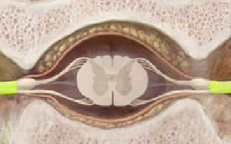 <p>what is the yellow color indicating in the spinal cord cross section</p>