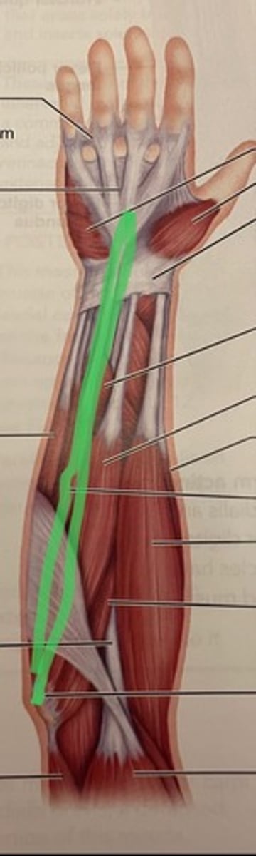 <p>O: medial epicondyle of humerus</p><p>I: palmar aponeurosis</p><p>A: flexes wrist (weakly)</p>