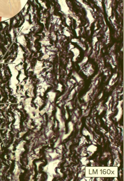 <p>What type of tissue?</p>