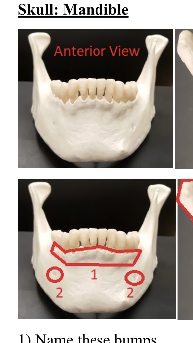 <p>1) name these bumps</p>