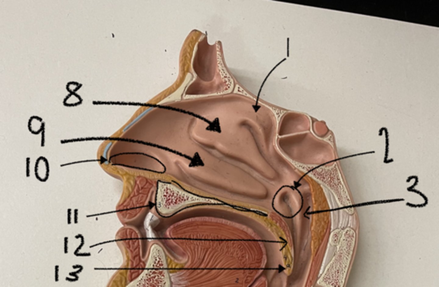 <p>what is structure 12</p>