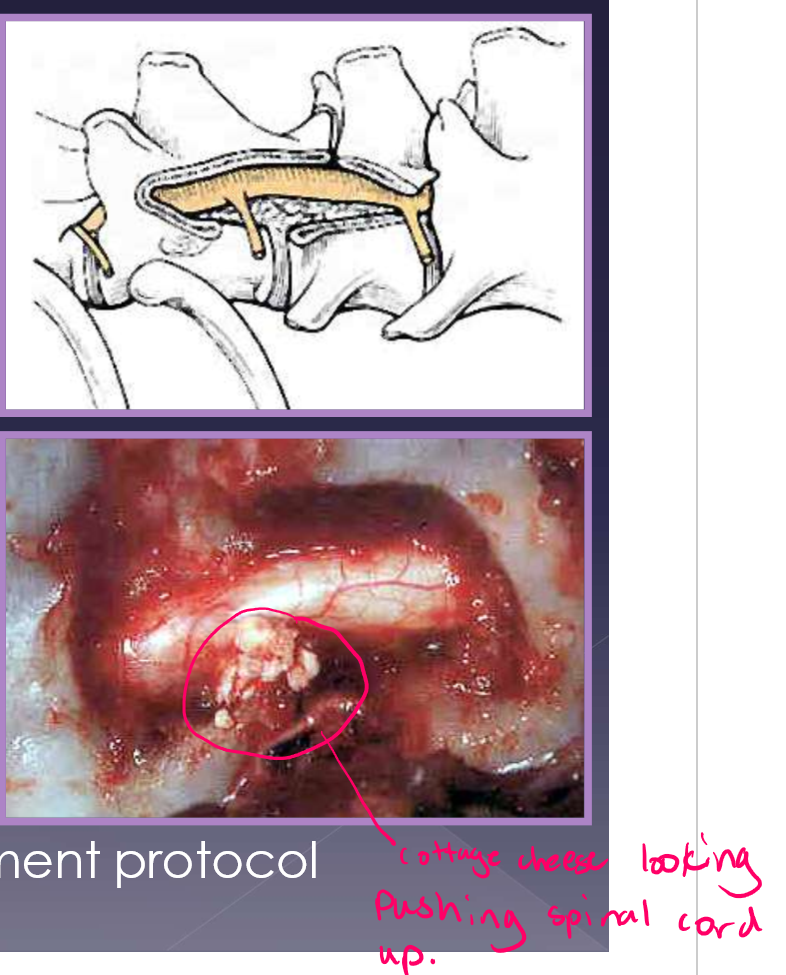 <ul><li><p>medical management </p><ul><li><p>goals </p><ul><li><p>reduce inflammation </p></li><li><p>disk resorption </p></li></ul></li><li><p>decreased motion </p><ul><li><p>crate rest x 4 weeks minimum </p></li><li><p>leash walks only </p></li></ul></li><li><p>pain medication </p><ul><li><p>Gabapentin - 10-14mg/kg TID </p></li><li><p>NSAID (carprofen, meloxicam) </p></li><li><p>± amantadine (4mg/kg SID-BID) </p></li></ul></li><li><p>reserved for </p><ul><li><p>pain only </p></li><li><p><strong>ambulatory paresis </strong></p></li></ul></li></ul></li><li><p>surgical management </p><ul><li><p>goal </p><ul><li><p>remove compression </p></li><li><p>reduce inflammation/pain </p></li></ul></li><li><p>reserved for: </p><ul><li><p><strong>nonambulatory paresis </strong></p></li><li><p><strong>plegia/paralysis </strong></p></li></ul></li><li><p>surgical procedure </p><ul><li><p>ventral slot diskectomy (cervical) </p></li><li><p>hemilaminectomy (TL) </p></li></ul></li><li><p>follow with medical management protocol </p></li></ul></li></ul><p></p>