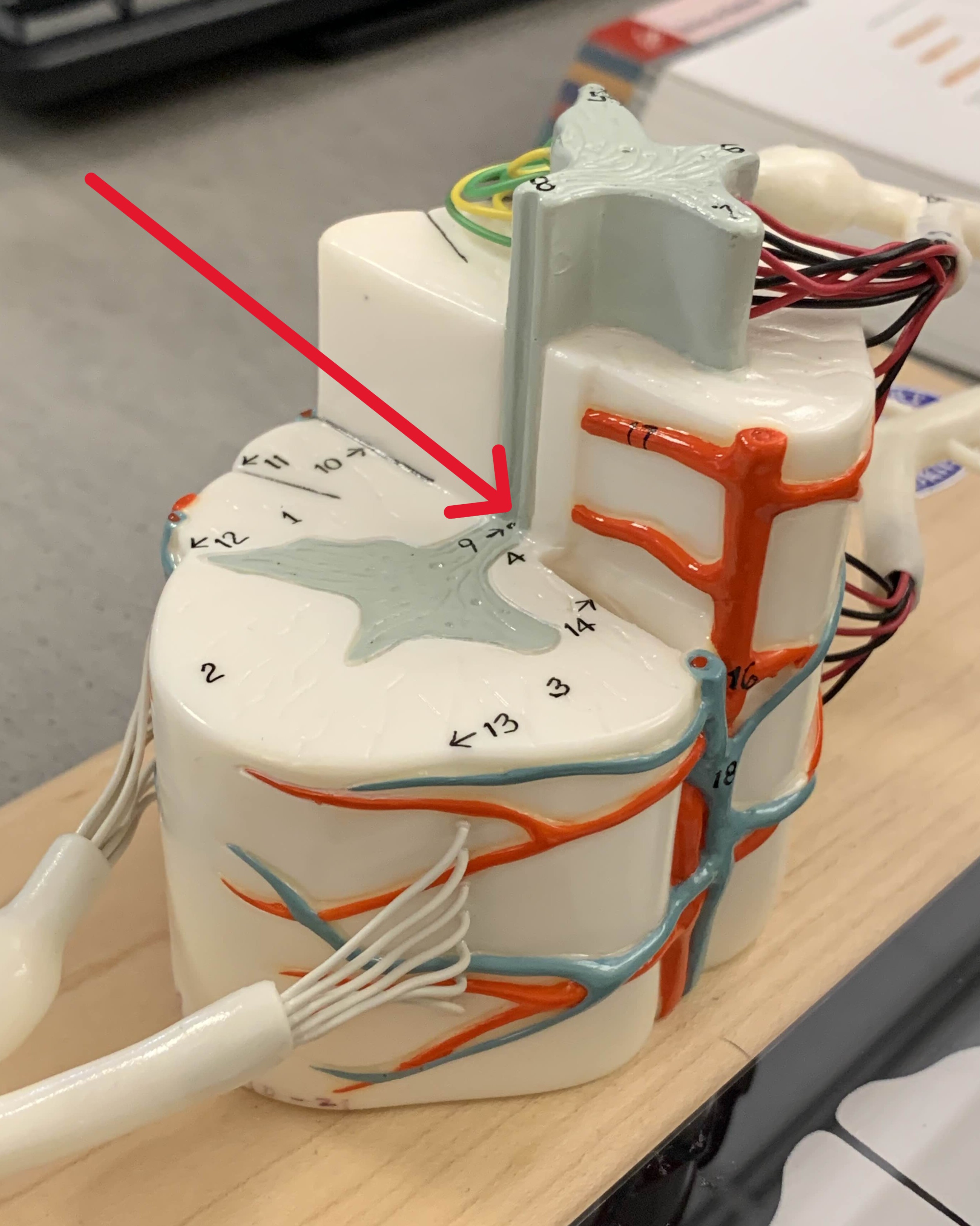 <p>Which part of the spinal cord is:</p><ul><li><p>Center hole</p></li><li><p>Run length of spine</p></li></ul><p></p>