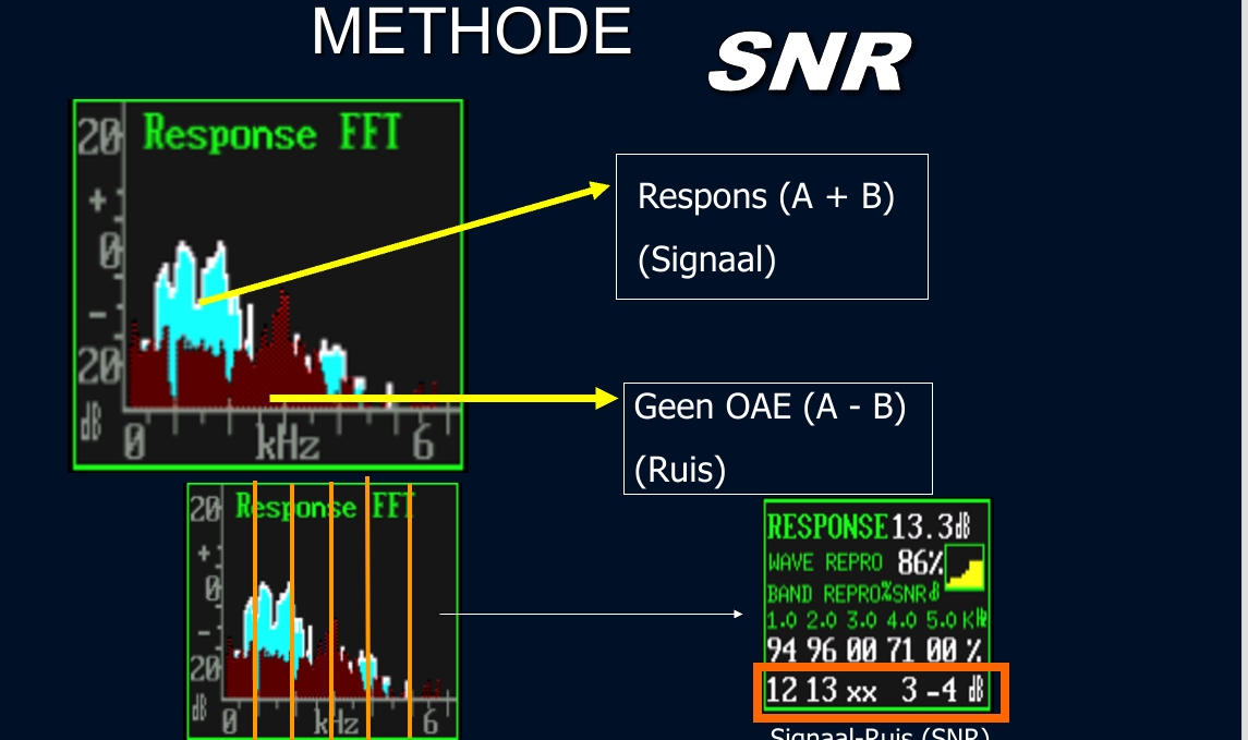 <p>interpretatie</p><ul><li><p><span>•AANWEZIGE OAE IN EEN SPECIFIEKE BAND:</span></p><ul><li><p><span>•<strong><em>SNR (dB) GROTER OF GELIJK AAN 2.4 dB (3 dB)</em></strong></span></p></li></ul></li><li><p><span>•AFWEZIGE OAE IN EEN SPECIFIEKE BAND:</span></p><ul><li><p><span><strong><em>SNR (dB) &lt;&nbsp; 2.4 dB (3 dB)&nbsp;</em></strong></span></p></li></ul></li></ul><p>Vb. 3de band niet te  (bij de rest is het signaal sterker dan ruis, behalve bij laatste dan is ruis 4dB sterker dan signaal))</p>