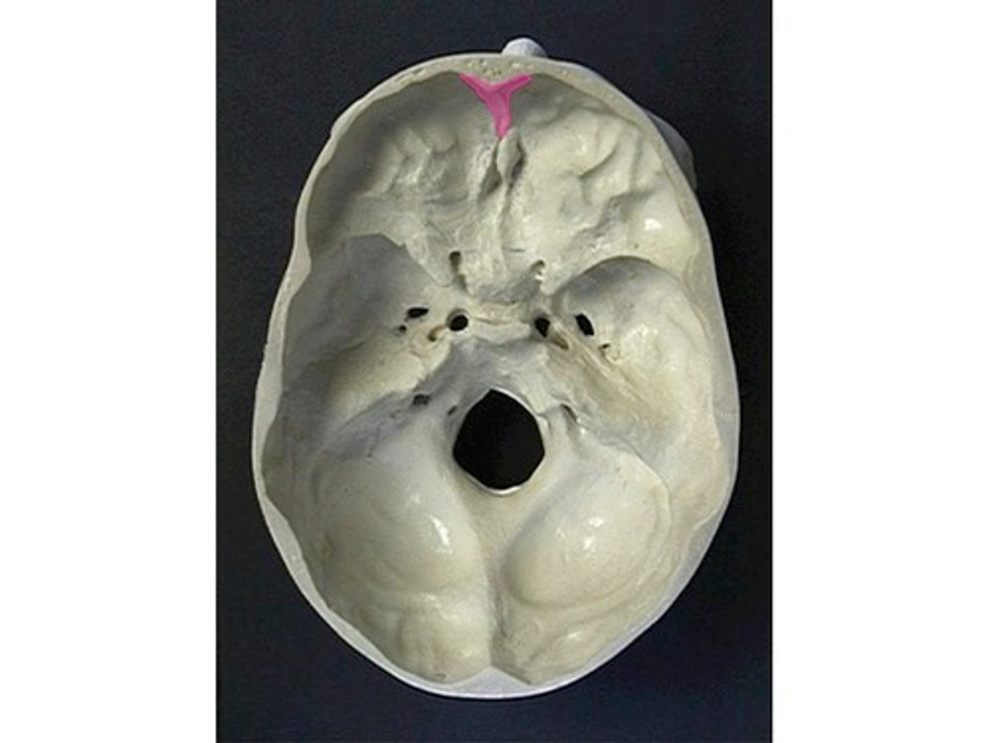 <p>midline crest confluent with the anterior end of the sagittal sulcus</p>