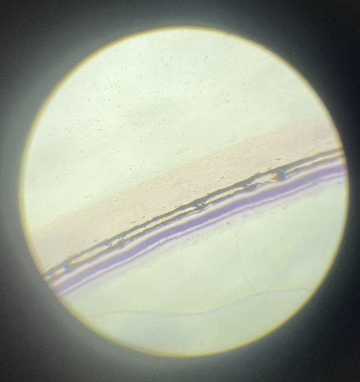 <p>Задня стінки ока </p>