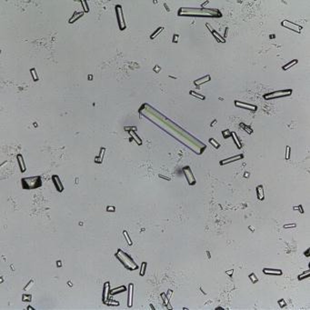 <p>Triple Phosphate Crystals.</p>