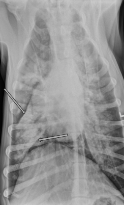 <p>What are the arrows pointing to? Pattern? </p>